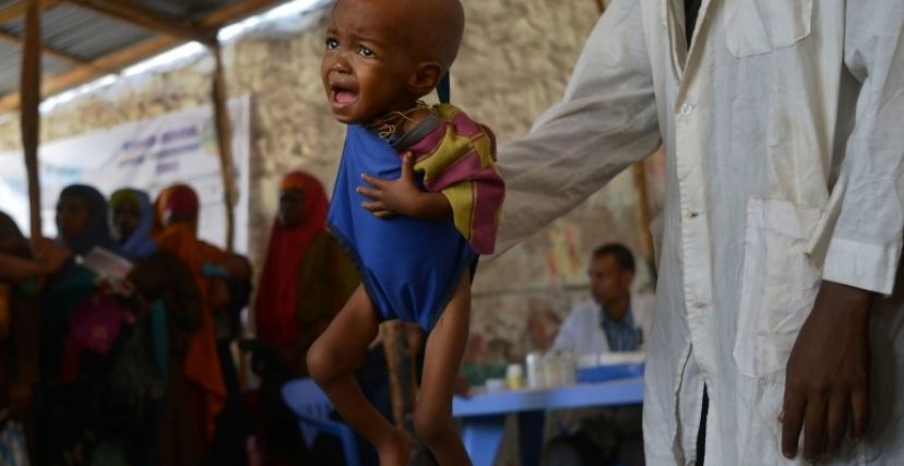 طفل في أحد المخيمات في السودان