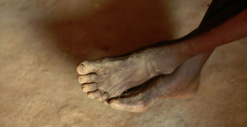 أقدام بشرية